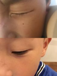 -清疣美疣·痣·斑净肤中心