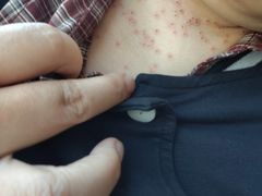 -大连市皮肤病医院