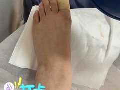 -世龙世家灰指甲鸡眼脚气甲沟炎跖疣护理(通州店)