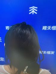 -雍禾植发全国连锁