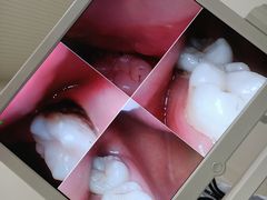 -永靓口腔.数字化种植矫正中心