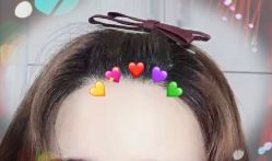 -大麦微针植发全国连锁