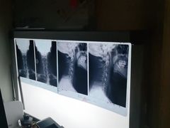 -张钰强中医正骨推拿连锁(华发商都店)