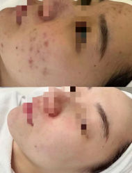 -康美贞·痘肌养护管理中心