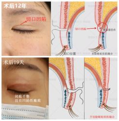 -丰联丽格医疗美容·联合丽格眼整形中心