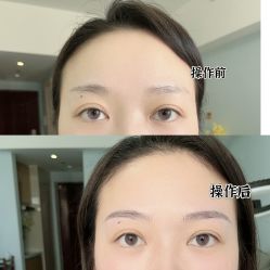 -MIVI半永久纹眉纹绣