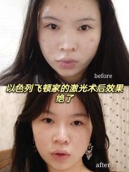 -深圳阳光医疗美容医院·旗舰店