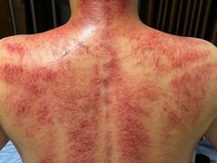 -顺则昌推按正骨理疗