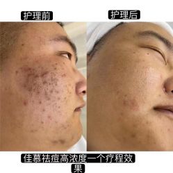 -佳慕·痘痘·问题肌管理中心