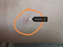 -上海市第八人民医院-体检中心