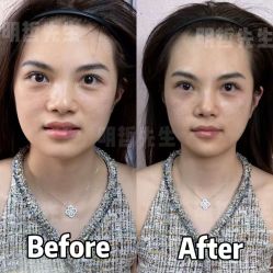 -颜和骨正&明星徒手小颜整骨