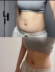 -Fundi张玉珊修身堂·indiba·BTL科技瘦身