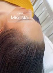-MISS STAR·半永久纹眉·发际线·美瞳线