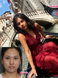 -北京米扬丽格医疗美容·联合丽格鼻整形中心