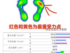 -Andrew指甲专科灰指甲·甲沟炎矫正·3D步态矫形鞋垫定制(上海法华镇路旗舰店)