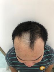 -发饰美男士增发补发假发定制店