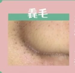 -蕾特恩专业祛痘·皮肤管理