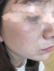 -初樱科技美学问题肌修复中心