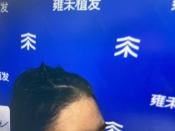 -雍禾植发全国连锁