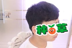 -大麦微针植发丨全国连锁