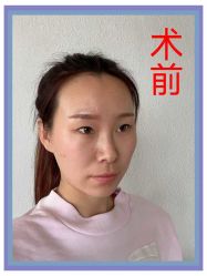 -苏州奥拉克美容医院