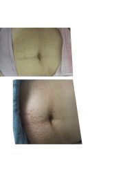 -妈妈乐专业无痛催乳满月发汗分娩体验(东川路总店)