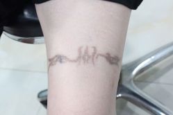 -雲艺刺青·洗纹身