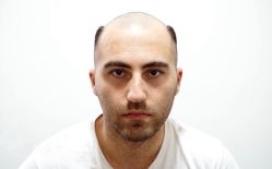 -发饰美男士增发补发假发定制店