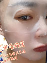 体验后-北京英煌医疗美容