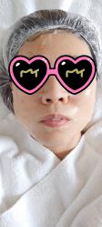 体验后-坤如玛丽·医疗美容中心