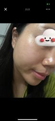 体验后-深圳艺星医疗美容医院
