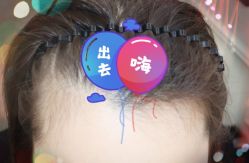 -大麦微针植发全国连锁