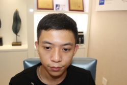 -大麦微针植发丨全国连锁