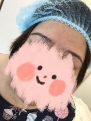 -莲姿娜半永久纹眉皮肤管理