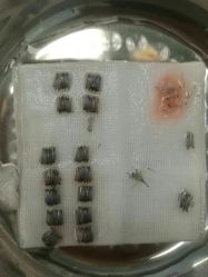 体验前-厦门美莱整形美容医院