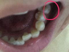 -北京市中关村医院