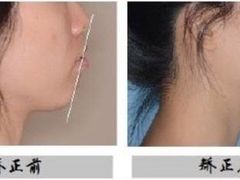 -团圆口腔·种植中心(锦江院区)