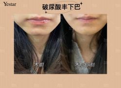 -Yestar艺星医疗美容医院