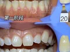 -精德口腔·种植修复·儿牙中心(财富中心店)