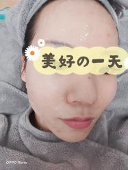 体验后-禾美嘉医疗美容