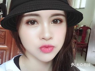 双眼皮和脂肪填充恢复好之后，感觉颜值也提高了不少