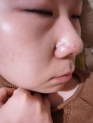 体验后-伽美医疗美容医院·高端抗衰中心