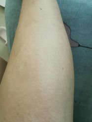 点击看大图 -深圳美莱医疗美容医院