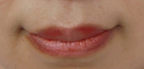 -苏州卫康美容医院