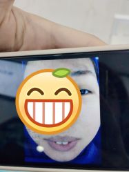 -蕾特恩专业祛痘·皮肤管理