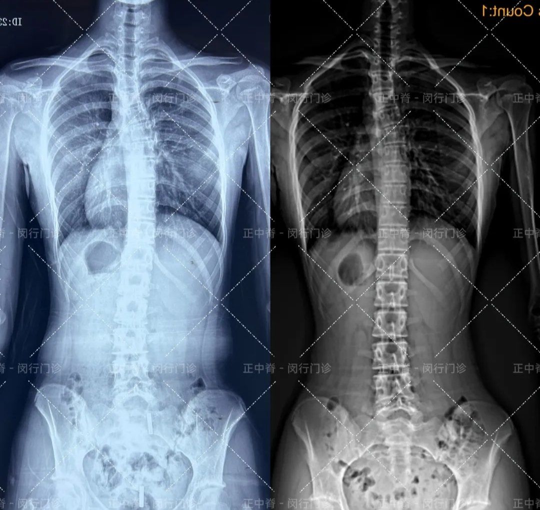 成长轨迹:骨骼x光对比