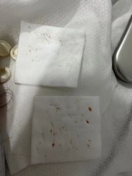 -悟空祛痘·诺奖技术专业店