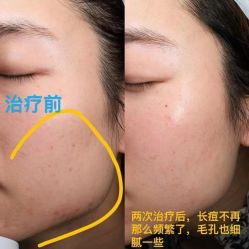 -Yestar重庆艺星医疗美容医院