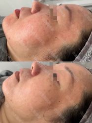 -蒂薇姿问题肌修复中心