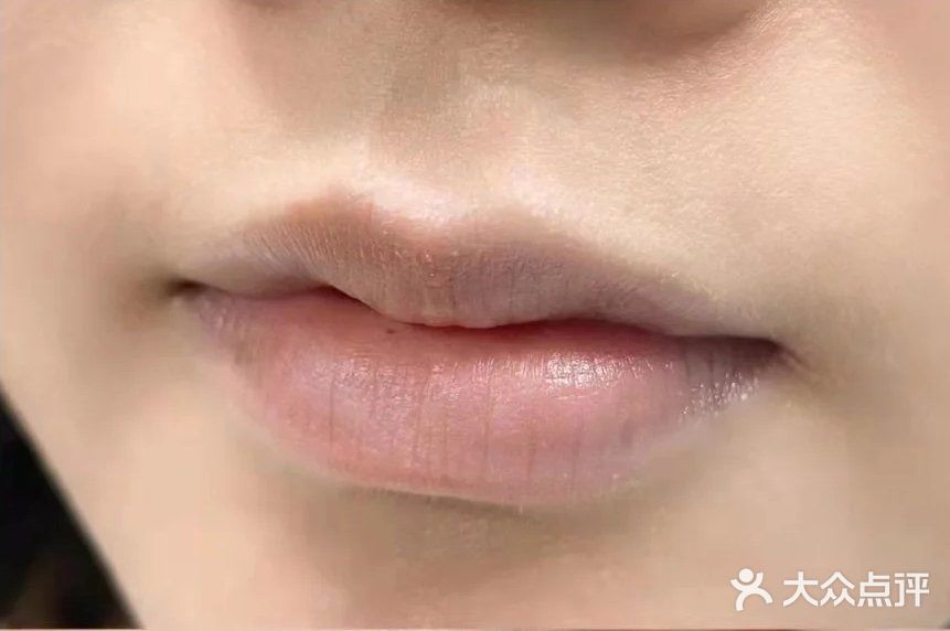 纹唇前后对比🆚，[糖果]太爱了叭